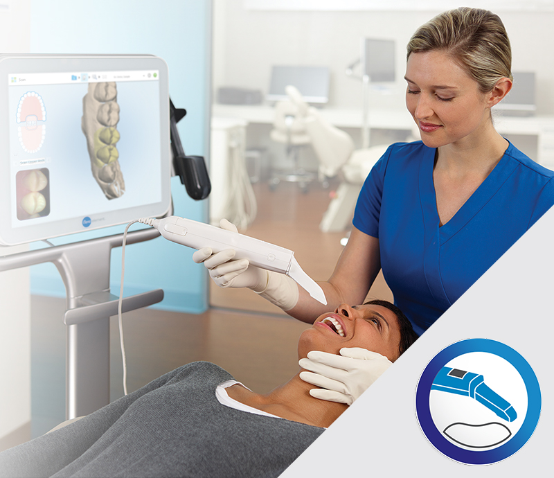 Intraoral-Scanning